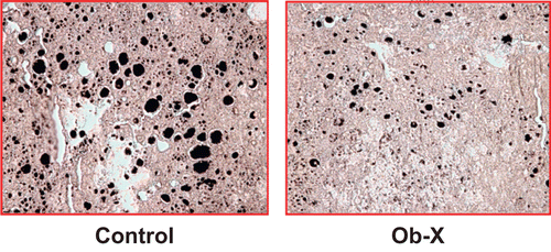 Figure 4.  Effects of Ob-X on hepatic lipid accumulation in genetically obese ob/ob mice. Livers were derived from mice receiving daily oral administration of saline (control group) or Ob-X at a dose of 0.5 mg/mouse/day (Ob-X group) for 5 weeks. Representative photographs of osmium tetroxide-stained sections of livers (original magnification 200×).