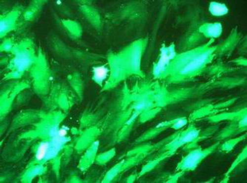 Figure 5. Cells transfected by adenovirus-green fluorescent protein 48 hour were almost green fluorescent.