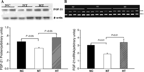 Figure 2.  Effects of visfatin/PBEF/Nampt overexpression on fibroplast growth factor-21 (FGF-21) mRNA expression and its plasma protein levels. A: Plasma FGF-21 protein levels (n=5 in each group, and each experiment was performed in triplicate); B: FGF-21 mRNA expression in liver tissue (n=5 in normal-chow diet with pcDNA3.1(+) plasmid infusion (NC) group; n=6 in normal-chow diet with pcDNA3.1-visfatin plasmid infusion (NT) and High-fat diet with pcDNA3.1-visfatin plasmid infusion (HT) group; each experiment was performed in triplicate).