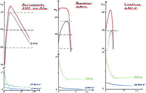 Figure 8.  Left: The depth dose curve for the open field is shown in black. To this curve we have to add the dose from electron contamination from the Perspex tray (green) and the transmitted photon dose from the electron fields. Middle: To the standard 10 MeV electron depth dose we must add the contribution from the photon field containing electron contamination and photon transmission. And on top of that the photon transmission from the electron field adds up. Right: The same situation as in Figure 6b but the transmitted dose is higher due to the higher electron energy.
