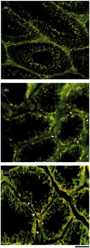 Figure 3. Fluorescent microscopic image of immunohistological staining of testis sections demonstrating deposition of anti-Monkey immunoglobulin (IgG)-FITC after vasectomy. (A) shamcontrol; (B) unoperated testes; and (C) operated testes. Arrow heads indicate the IgG deposition in the basal compartment of the seminiferous epithelium. In all testes IgG deposition was restricted to the basal compartment of the seminiferous tubules and not elsewhere. In unilateral vasectomized animals, the immunoglobulin depositions were seen in both operated and unoperated testes. However, the quantum of deposition in the unoperated side was not as severe as in the operated side. Scale bar = 80 µm.