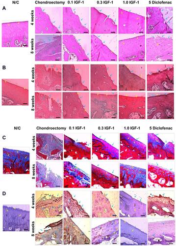 Figure 7 Effects of IGF-1 on (A) hematoxylin-eosin staining (B) safranin O (C) masson’s trichrome staining for the existence of the cartilage during the OA in rabbit femoral condyle after treatment of at 4 and 8 weeks and (D) immunohistochemistry staining for the existence of MMP-1 in the cartilage at 4 and 8 weeks in vivo (× 200, scale bar = 200 μm). Yellow arrow indicated chondrocyte cell and blue arrow indicated erosion of condyle and positive MMP-1 (IHC).