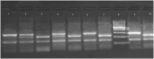 Figure 2. XPD 751 genotypes on ethidium bromide stained 3% agarose gel. Lanes 1, 6 and 9 are homozygous Lys/Lys genotype. Lanes 2 and 4 are heterozygous Lys/Gln genotype. Lanes 3, 5, 7 and 10 are homozygous Gln/Gln genotype. Lane 8 is 100 bp ladder.