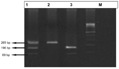 Figure 3 Polymerase chain reaction (PCR)-based analysis of vitamin D receptor (VDR) gene Fok1 polymorphism.