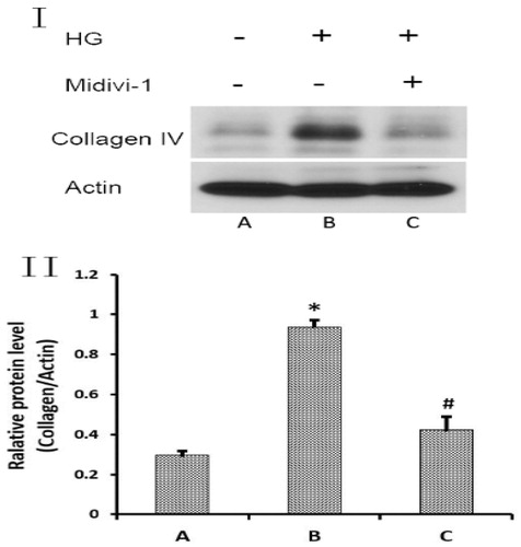 Figure 4. Intervention of Midivi 1 can reduce the expression of collagen 4. (I) Protein expression of collagen IV (Western blot). (II) Relative protein level of collagen IV (*p < 0.05 when compared with group A; #p < 0.05 when compared with group B).