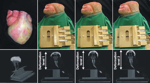 Figure 3. Top: The phantom heart at different deformation levels controlled by the oil-filled pistons (only three are shown here), allowing for reproducible deformation control. Bottom: The reconstructed phantom heart from a series of CT slices. [Color version available online.]