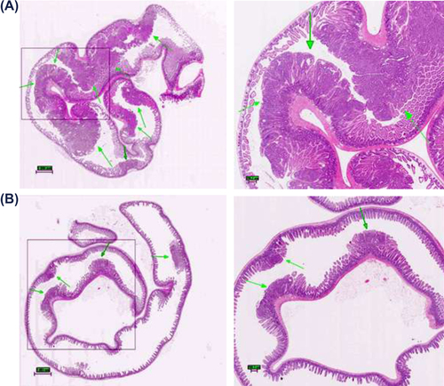 Figure 2. Histological evaluation: intestinal changes in the small intestines of ApcMin mice; (A) Multiple lesions found in control group animal, arrows point to high- (control group) and low-grade (treatment group) adenomas; note: magnified tumor shows features resembling adenocarcinoma, with the initiation of cribriform pattern features (top arrow); Diagnosis of possible adenocarcinoma was based on cellular and nuclear pleiomorphism and loss of cell polarity. Architectural abnormalities such as the presence of intraglandular papillary projections and cribriform and solid areas were also present; the presence of flat destructed villi and intestinal glands was also observed throughout analysis of individual samples of animals from control group. (B) Microadenomas found in treatment group animal; note: the unobstructed intestinal lumen and well-defined, healthy microvilli composed of columnar epithelial cells. Magnification: 4× (left), 20× (right). All tissues were stained with hematoxylin and eosin.