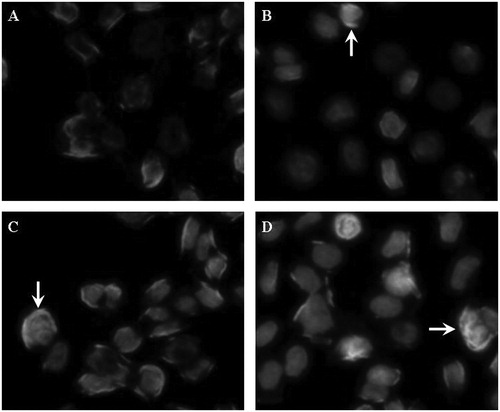 Figure 1. Morphologic changes of PC-3 cells treated with various concentrations of formononetin for 48 h. (A) Representative image of cells from the non-treated group. (B–D) Representative images of cells treated with 25, 50 and 100 μM formononetin, respectively. The apoptotic cells showed condensed nuclei or apoptotic bodies (indicated by arrows). The images were taken using an Olympus IX71FL fluorescence microscope (400×).