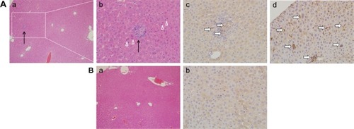 Figure 4 Histological observation (Aa, Ab, Ba) and immunohistochemical staining (Ac, Ad, Bb) of macrophage surface molecular marker F4/80 in hepatic tissue sections.Notes: (A) Experimental group (35 mg/kg dosage group); (B) control group (saline-treated group). Magnifications: (a) 100×; (b–d) 400×. Black arrows indicate the diffuse lymphocytic aggregation. White triangles show the focal necrosis of cells. White arrows point to the F4/80 positive cells.