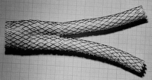 Figure 1 Deployed AneuRx stent-graft manufactured by Medtronic-AVE. The device is made by assembling a bifurcation with asymmetrical limbs with an ipsilateral limb. The thin wall of the woven polyester tubes is externally supported by self–expanding stents made of Nitinol, a shape memory alloy, and sewn by means of a polyester suture. The cross-section investigated is given by the transversal double-headed arrow.