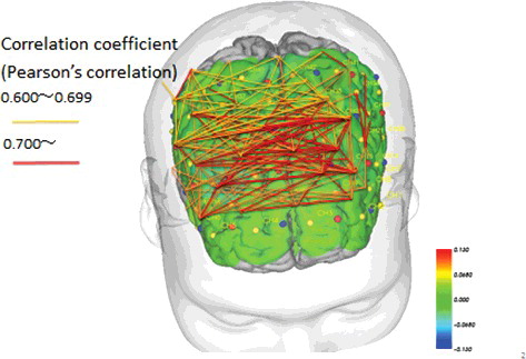 Figure 7. Pre- and post-intervention brain blood flow and correlations between channels in the MMT group (p < .05).