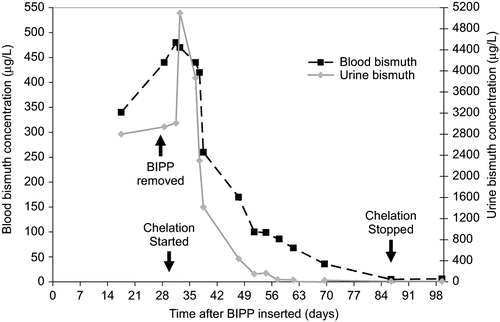 Fig. 1.  Blood and urine bismuth concentrations following bismuth iodoform paraffin paste (BIPP) insertion, and the effect of DMPS [2,3-dimercaptopropane-1-sulphonate] chelation therapy.