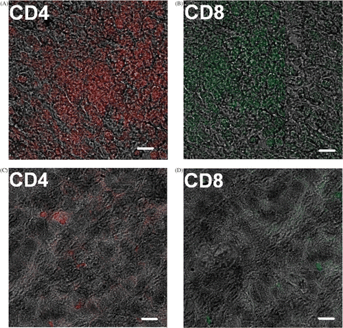 Figure 5. Immunohistochemical staining for immunocytes. Anti-CD4+, CD8+ cells antibodies conjugated to different fluorescent residues were used to observe the infiltration of T cells into the tumor debris. (A), (B): tumor debris after the alternating cooling and heating treatment; (C), (D): tumor without any treatment (Scale bar, 5 µm).