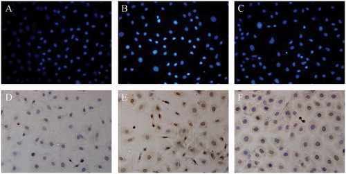 Figure 2. Staining with Hoechst 33258 and immunocytochemistry. (A and D) cells from control group, (B and E) cells from H/R group, (C and F) cells from ozone 40 preconditioning group. (A–C) Hoechst 33258 staining. (D–F) cleaved caspase-3 immunohistochemical staining. All Hoechst 33258 and immunohistochemical staining, original magnification ×200.