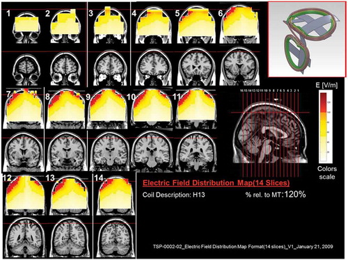 Figure 14. Colored field maps for the H13-coil indicating the absolute magnitude electrical field in each pixel at 120% of hand motor threshold, for 14 coronal slices 1 cm apart. Red pixels indicate regions with field intensity above the threshold for neuronal activation. Full color available online.