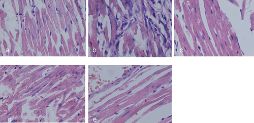 Figure 4.  Representative HE staining of the myocardium in rats (×400). (a), (b), (c), (d), and (e) correspond to groups: (a) control group showing normal cardiac fiber without inflammatory cells; (b) AMI group showing multiple focal necroses with infiltration of inflammatory cells; (c-e) AMI rats treated with CTI (0.625 and 2.5 g/kg) and XD (20 g/kg).