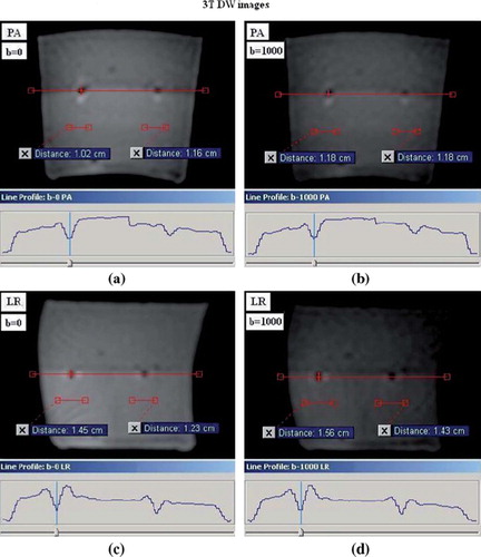 Figure 4. The lateral intensity line profile across the reconstructed FMAs in 3T DW image slices, obtained with phantom in position 1; (a) and (c) shows DW image slices for b-value 0 and the PE direction applied in the posterior-anterior (PA) and left-right (LR) direction, respectively, (b) and (d) shows DW images for b-value 1000 and the PE direction applied in the PA- and LR direction, respectively.