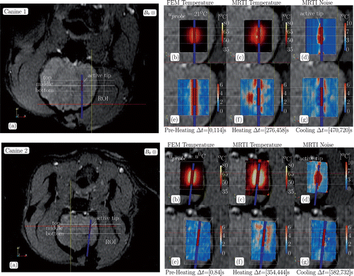 Figure 3. Canine 1-2 data summary, CDA, (a) The anatomical position of the ROI and the spatial profiles used in Figure 5 are illustrated on magnitude images of the anatomy. Cutplanes through the ROI of the finite element data used in Figure 2 is shown in (b–g). Cutplanes are coplanar with the applicator. The pointwise maximum over time for the (b) FEM predicted temperature, (c) MR temperature data, and (d) MR temperature noise is provided in °C. The pointwise maximum normalised error (5) over time for the (e) pre-heating, (f) heating, and (g) cooling regimes labelled in Figure 2 are provided.