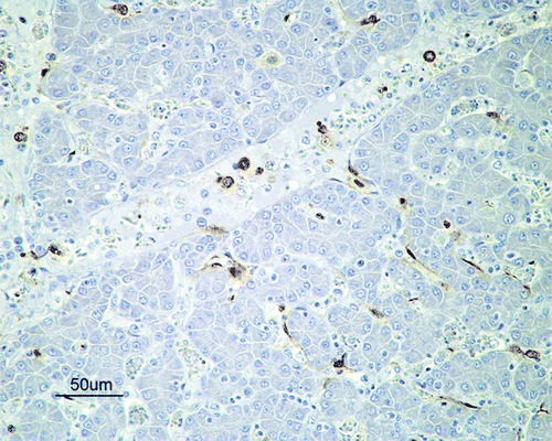 Figure 2.  Immunohistochemical detection of influenza A viral nucleoprotein in the liver of SPF chickens inoculated intranasally with 105.5 ELD50 (G1) of H7N1 A/Chicken/Italy/5093/99 at 5 d.p.i. Influenza A viral antigen detected in Kupffer cells, endothelial cells and mononuclear intravascular cells in the liver.
