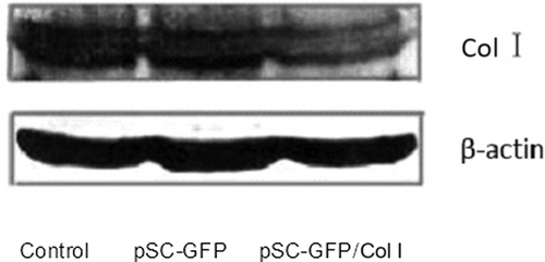 Figure 3. Protein expression of Col I in different groups was detected by Western blot. The protein expression of pSC-GFP group and pSC-GFP/Col I group was normalized by that of control group.