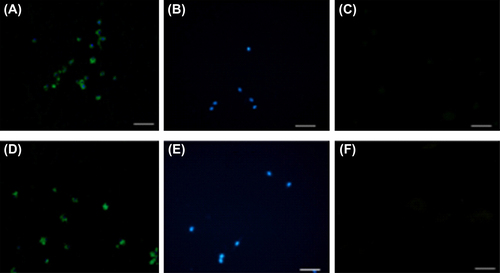 Figure 11. Immunocytochemistry for the expression of osteoblast markers, 6 days after the implantation of differentiated cells on the scaffolds. Osteopontin (A: osteopontin specificity marker, B: 4,6-diamidino-2-phenylindole dihydrochloride, and C: negative control) and osteocalsin (D: osteocalcin specificity marker, E: 4,6-diamidino-2-phenylindole dihydrochloride, and F: negative control); Scale bar: 100 μm.