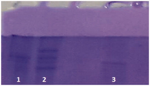 Figure 2. SDS-PAGE photograph. Lane 1: truncated β-galactosidase (83 kDa). Lane 2: standard proteins: truncated β-galactosidase (83 kDa), bovine albumin (66 kDa) and bovine carbonic anhydrase (29 kDa). Line 3: AmCA estimated molecular weight 37 kDa.