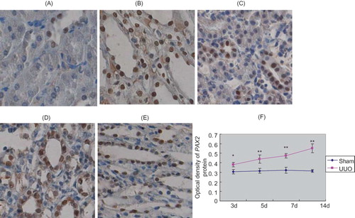 FIGURE 4. PAX2 protein expression in rat renal tissues. In renal cortex of sham group, no PAX2 expression was detected in renal tubular epithelial cells, PAX2 expression was detected in collecting duct epithelial cells (A). In renal medulla of sham group, relative abundant PAX2 expression was seen in collecting duct epithelial cells (B). At 3d after UUO, PAX2 expression appeared in renal tubular epithelial cells and collecting duct epithelial cells (C). At 14d after obstruction, PAX2 expression became more pronounced in renal tubular epithelial cells (D). At 14d after obstruction, PAX2 expression was detected in collecting duct epithelial cells of renal medulla (E). Original magnification ×400. In UUO group, average optical density of PAX2 protein significantly increased with prolonged obstruction (F).