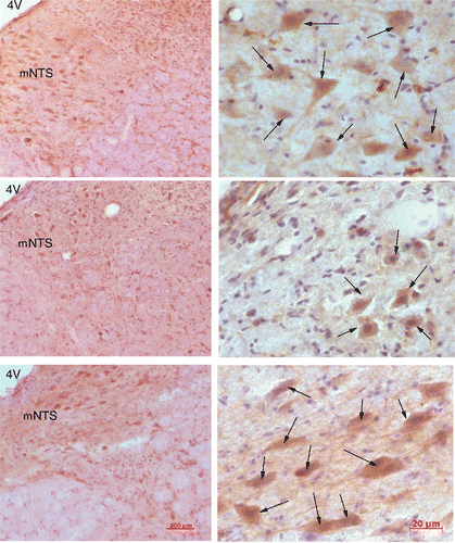 Figure 5. Micrographs, low (left) and high (right) magnification, showing number of POMC positive staining neurons in the medial NTS (mNTS) of an OR control (top), OP control (middle), and OP heated rat (bottom). POMC staining cells (indicated by arrows) were increased in the mNTS in the heat-treated OP rat (bottom) and OR control rat (top) when compared to the OP control (middle).