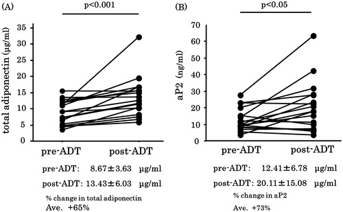 Figure 2. Changes in total serum total adiponectin (A) and aP2 (B) levels during ADT. Both adiponectin and aP2 levels were significantly increased post-ADT. Each black circle signifies a prostate cancer patient. Values are expressed as mean ± SD.