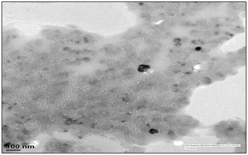 Figure 3. TEM image of transfersomal gel.