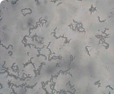 Figure 8. Microscopic observation drug-susceptibility assay.Characteristic tangling appearance of cords of Mycobacterium tuberculosis as visualized at ×20 magnification under an inverted light microscope. Image courtesy of David AJ Moore and Luz Caviedes and reproduced with permission.