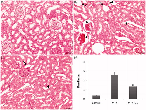 Figure 1. Light microscopy of renal cortical tissues in different groups for H&E. (a) In control, normal renal tissue morphology was seen. (b) After MTX, severe tubuler and glomeruler damage was noted. (c) QE treatment prevented tubuler and glomeruler damage compared with alone MTX group. (d) Renal injury degree was significantly decreased in the MTX + QE group when compared to MTX group. Asterisk: glomerular congestion and degeneration, Arrowhead: tubular cell swelling, Arrow: tubular dilatation. (H&E, scale bar, 50 μm). ap < 0.001 compared to control group, bp < 0.01 compared to MTX group.