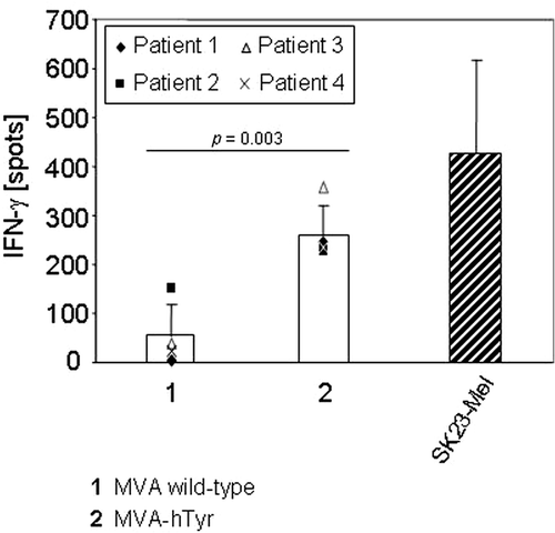 Figure 4. IFN-γ secretion of TyrF8 T cells achieved by primary sarcoma cells infected with MVA-hTyr. Primary HLA-A2+ sarcoma cells (n = 4 patients) were infected with MVA wild-type (bar 1) or MVA-hTyr (bar 2) as indicated and co-incubated with TyrF8 CTLs at an E:T ratio of 1:5 for 24 h. Control cell line SK23-Mel (HLA-A2 positive with endogenous tyrosinase expression) was used at the same E:T ratio. IFN-γ ELISPOT was performed. Results are shown as mean ± SEM of four independent experiments. P values indicate statistical significance between MVA wild-type control (1) and MVA-hTyr infected (2) cells.