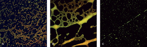Figure 1. CLSM images. A. Biofilm-positive S. aureus (strain P-1). B. Biofilm-positive S. epidermidis (strain P-6.5). C. Biofilm-negative S. aureus (strain P-41).