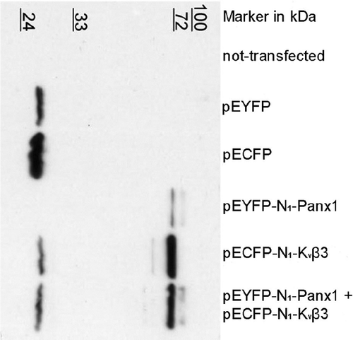 Figure 2. Western-blot analyses of transfected Neuro2A cells. Neuro2A cells were transfected with 400ng DNA and lysed 48 h later. 12 μg protein was loaded in case of double-transfected cells and 8 μg in case of single-transfected cells. Immunodetection was carried out using BD-Living Colors A.v. Peptide antibody (BD Biosciences).