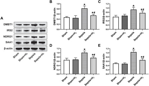 Figure 8 Effects of H2 on the protein expressions of DMBT1, IRS2, NDRG1, and SAA1 in intestinal tissue of septic mice. The intestinal samples were harvested at 24 h after sham or CLP operation. The protein expressions of DMBT1, IRS2, NDRG1, and SAA1 measured by Western blot (A). Quantitative analysis of DMBT1 (B), IRS2 (C), NDRG1 (D), and SAA1 (E) is shown as the ratio of band density to that of β-actin respectively. Results were displayed as mean ± SD (n = 6). *P< 0.05 versus Sham group, #P < 0.05 versus Sepsis group.