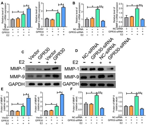 Figure 3 GPR30 might affect MMP-1 and MMP-9 expression. (A, C and E) qRT-PCR and Western blot analysis showed that the levels of MMP-1 and MMP-9 were markedly enhanced with E2 treatment, after transfected with PcDNA3.1 (+)-GPR30 or control for 24h. (B, D and F) the levels of MMP-1 and MMP-9 were markedly decreased with 10–8 M E2 treatment, after VSMCs transfected with GPR30-siRNA or control for 48h. The data were analyzed using Student’s t-test and are presented as mean ±SEM in the figures. *P<0.05 and **P < 0.01. The data are representative of 3 independent experiments.
