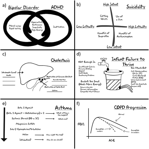 Figure 1. Examples of figures that work well for collaborative construction in the mini-chalk talk format: (a) Venn diagrams are useful for showing overlap of symptoms such as those in bipolar disorder and Attention Deficit Hyperactivity Disorder (ADHD); (b) two by two tables allow for comparisons of features on two spectra as in this paradigm for degree of lethality vs. intent in suicide attempts; (c) simple anatomy drawings can be used to encourage discussion about causes of disease by location, such as cholestasis – note the blank spaces represent the fact that learners should be encouraged to help build the figure; (d) visual paradigms/analogy can be useful for discussing categorization of causes of diseases, such as failure to thrive in an infant; (e) pathways can be built in real time for escalating treatment options; (f) simple graphs can be used to visually represent concepts such as disease progression.