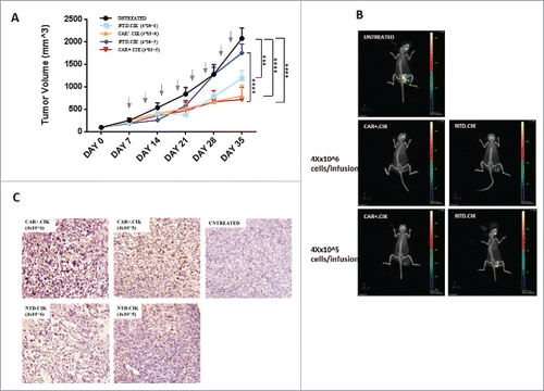 Figure 4. In vivo anti-sarcoma activity of antiCD44v6 CAR+.CIK. CAR+.CIK were intravenously infused, every 3–4 days (total 8 infusions), in NOD/SCID mice bearing subcutaneous patient-derived UPS xenograft. Two different doses (4 × 105 and 4 × 106 per infusion) of CAR+.CIK were explored. We observed a significant delay of tumor growth in mice (n = 6) treated with CAR+.CIK cells (4 × 105), compared with untreated controls (n = 6, p< 0.0001) or treated with equivalent doses of paired NTD.CIK cells (n = 6, p< 0.0001). A similar antitumor activity was observed with 1 log-higher dose of CAR+.CIK (4 × 106). Arrows indicate CIK cell infusions. Results were analyzed by Two way Anova and correction for multiple comparisons test using Bonferroni method: Statistical significance is expressed as * P ≤ 0.05; ** P ≤ 0.01; *** P ≤ 0.001; **** P ≤ 0.0001 (A). In selected cases (1 representative mouse per group, n = 5) results were confirmed by a 3D imaging analysis based of fluorescent glucose uptake (B). Tumor homing of CAR+.CIK was confirmed by IHC in explanted tumors by staining with anti-human CD3 antibody (C). Abbreviations: CAR Chimeric Antigen Receptor; NTD, Not Transduced; NOD SCID mice, Non obese diabetic/severe combined immunodeficiency mice.
