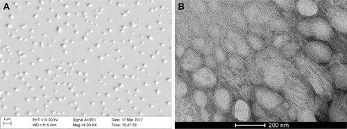 Figure 3 SEM (A) and TEM image (B) of the optimized liposome formulation.Abbreviations: SEM, scanning electron microscopy; TEM, transmission electron microscopy.