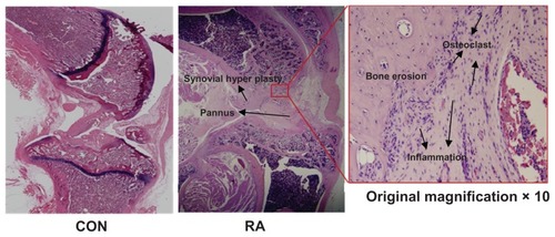 Figure 6 Representative histologic image of a knee joint with control, rheumatoid arthritis (RA) and a ×10 magnification of the section of RA (inset), showing evidence of bone erosion, inflammation, pannus formation, and synovial hypertrophy (black arrows).
