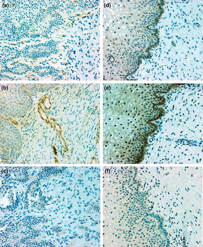 Figure 3. Immunohistochemical localization of endothelial nitric oxide synthase (eNOS) (left panels, a–c) and inducible nitric oxide synthase (iNOS) (right panels, d–f) in cervical specimens from women without (a, d) and with (b, e) high-risk human papillomavirus. Endothelial NOS was localized to the vascular endothelium and iNOS mainly to the basal layer of epithelial cells. Specimens incubated with irrelevant antibody (IgG) showed no immunoreactivity (c, f). Hematoxylin counterstain, × 200 magnification.