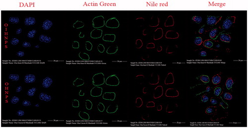 Figure 13. Fluorescent images of hybrid nanoparticles loaded with three fluorescence dyes in cell. In vitro fluorescence images of MCF-7 cells (TRAIL-negative) after incubation with OIHNPs-(Nile red)-DAPI-Actin green and OHNPs-(Nile red)-DAPI-Actin green for 1, 3, 5 or 7 h to measure intracellular drug release profiles. Initial first row (vertical) represents nuclei stained with DAPI, which was followed by an second row of actin filaments and third row of nile red nanoparticles that was present outside the nuclei in the fourth row (vertical).