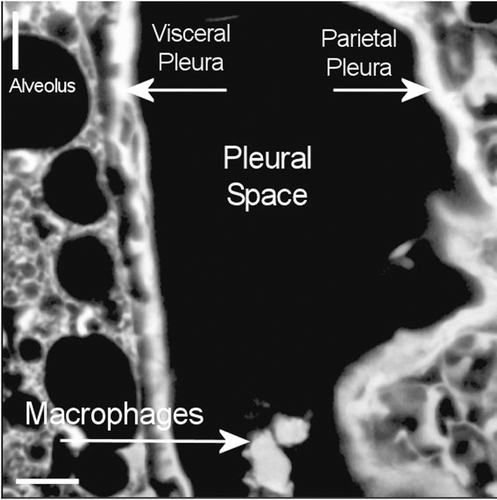 Figure 13.  View of the pleural space at 181 days postexposure from a control animal is shown in the confocal image. The subpleural alveolar septa is seen on the left with the parietal pleura shown on the right. The brighter white is indicative of collagen in the visceral and parietal pleural walls. Free macrophages are present within the pleural space (bottom middle).