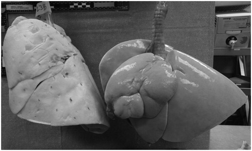 Figure 2. The excised canine lung (right) with lung volume reduction compared to a dried lung (left) from an untreated canine of similar size.