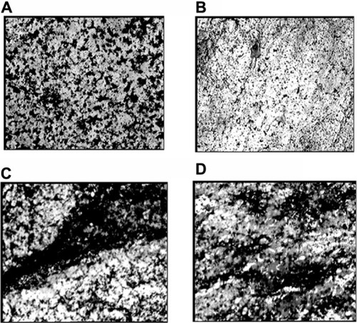 Figure 10 von Kossa stained scaffolds showing calcium deposits as black-colored patches with 250× magnification. (A) PCL (positive control), (B) PCL (negative control), (C) PCL-RNP, and (D) PCL-Res.Note: Positive control, cell culture done on PCL scaffold in osteogenic medium; negative control, cell culture done on PCL scaffold in DMEM-LG medium.Abbreviations: PCL, polycaprolactone; RNP, resveratrol-loaded albumin nanoparticles; Res, resveratrol; DMEM-LG, Dulbecco’s Minimum Essential Medium-Low Glucose.