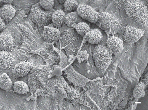 Figure 19.  Scanning electron micrograph of the diaphragm from amosite-exposed group at 90 days after cessation of exposure. The surface of the amosite-exposed diaphragm shows extensive inflammatory proliferation with numerous activated inflammatory cells. The micron bar is 2 µm in length.
