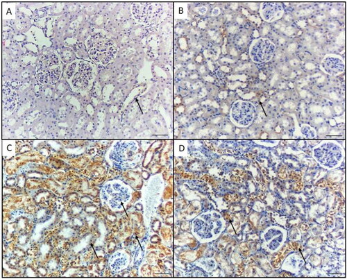 Figure 4. Caspase-1 immunohistochemical staining in the kidney of mice in the different groups. A) Control group and B) Mice treated by gallic acid alone showing minimal Caspase- 1 reactivity in the proximal tubular cells (arrows). C) Mice treated by NiO-NPs only showing high Caspase-1 immunoreactivity in the proximal and distal tubular cells, and podocytes (arrow). D) Mice treated by NiO-NPs and gallic acid showing mild Caspase-1 immunoreactivity in the proximal and distal tubular cells (arrows). Original magnification 200X, scale bar 50 µm.