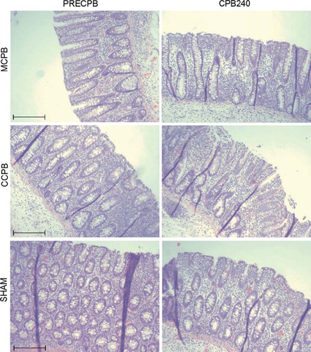 Figure 3. Micrographs of hematoxylin/eosin (HE-)-stained sections of colon biopsies of animals in the MCPB (first row), CCPB (second row) groups and in a sham animal (third row) at baseline and at 240 minutes on CPB. Bar = 250 μm.