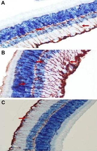 Figure 3 Micrographs of retinal glial fibrillary acid staining for one rat in each treatment group.